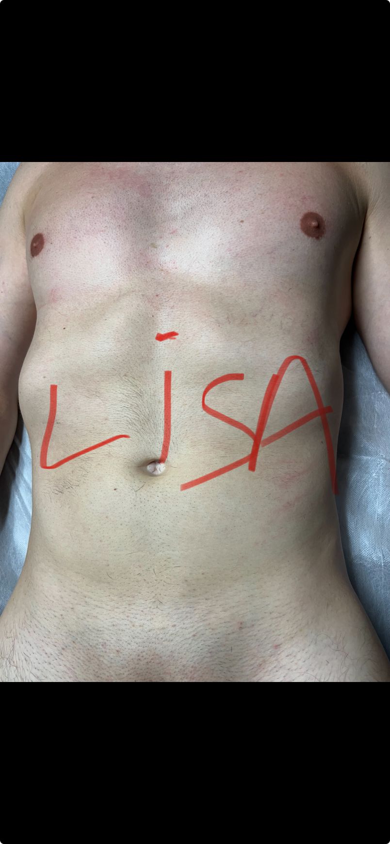 Lisa 2